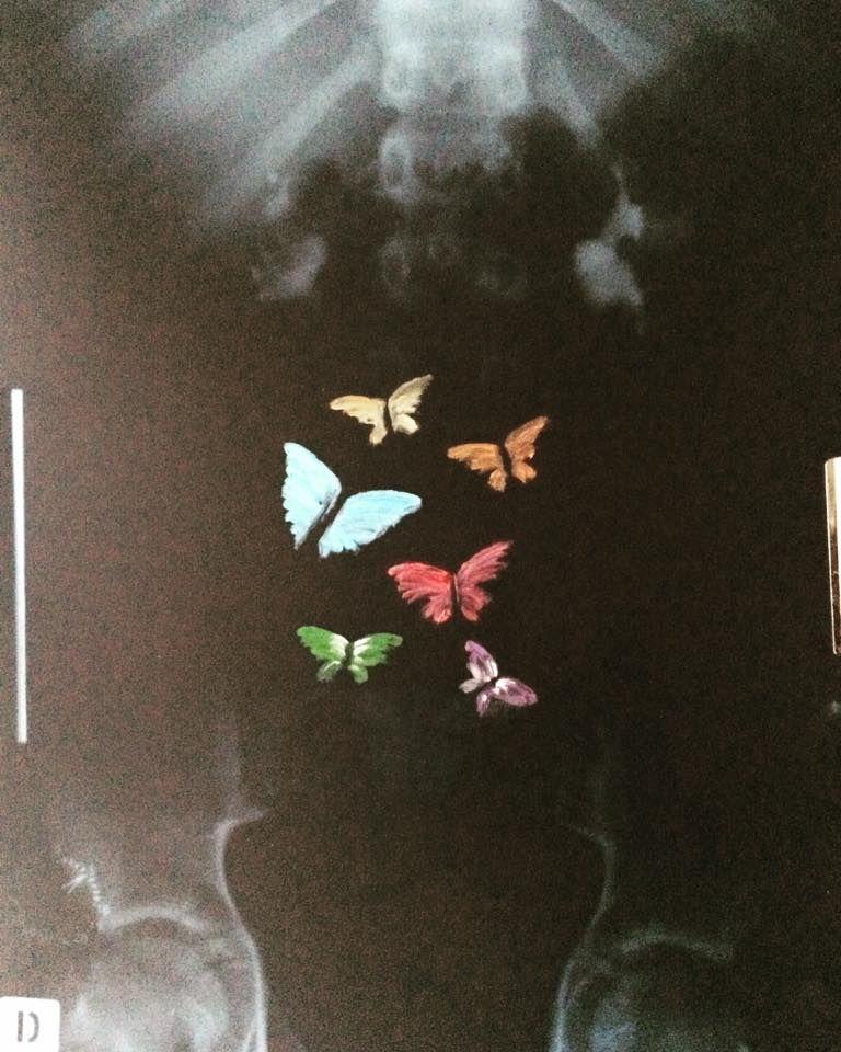 Butterflies Diagnosis Oil On Xray 2018