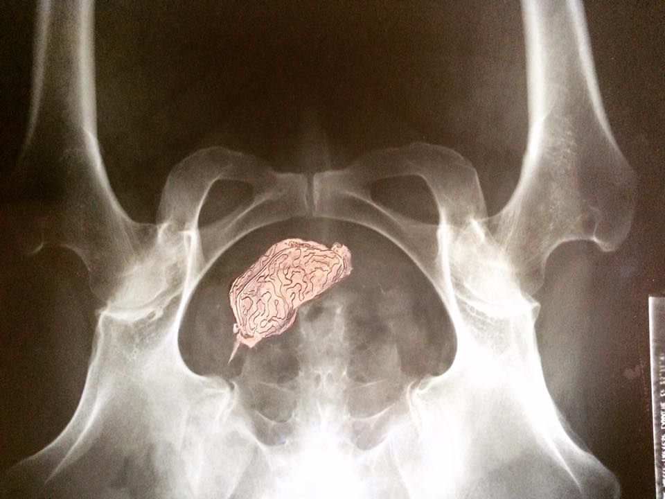 The Reason We Hit Deer Oil On Xray 2018